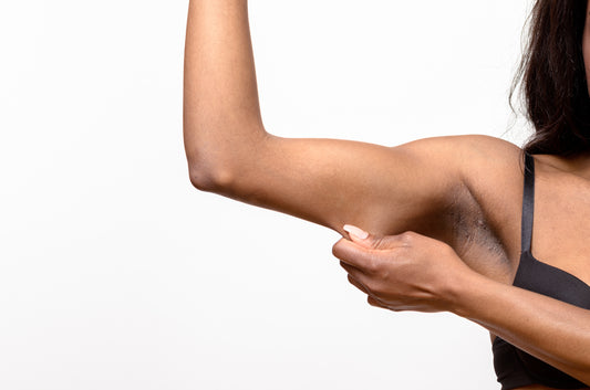 Brachioplasty (Arm Lift)