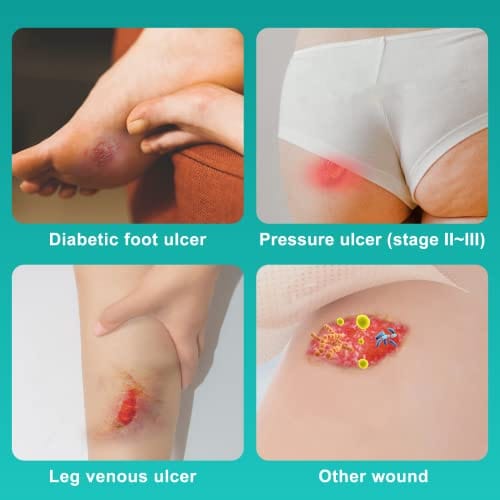 Dimora Wound Dressing Sacrum Foam Bandages Silicone Adhesive Border 7"x7" Waterproof Sacral Pads Absorbent Breathable Bed Sore Pressure Dressing