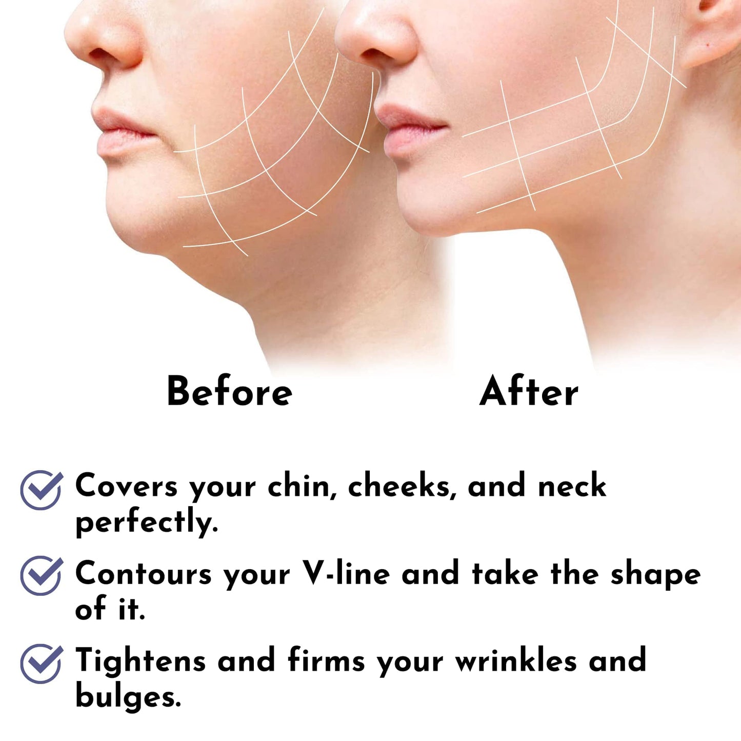 Post Surgery Facial Compression Neck Coverage Chin Strap, V-Shaped